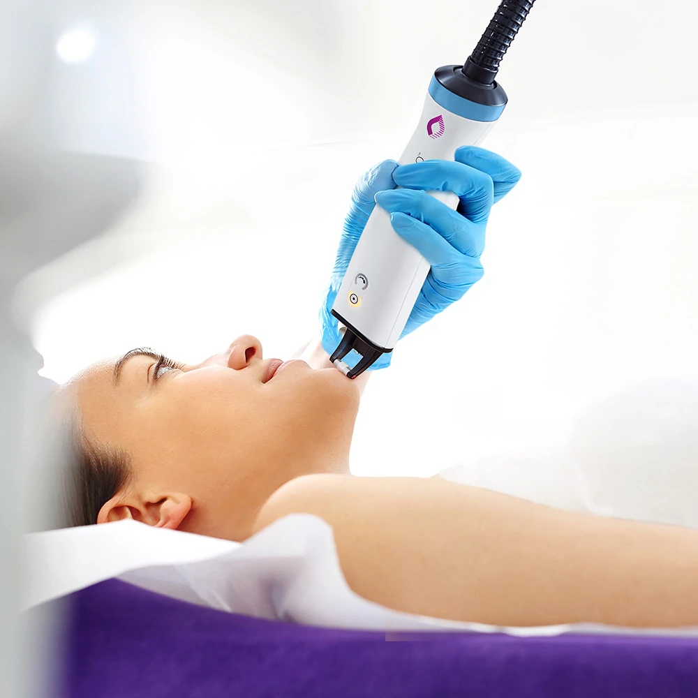fractional laser