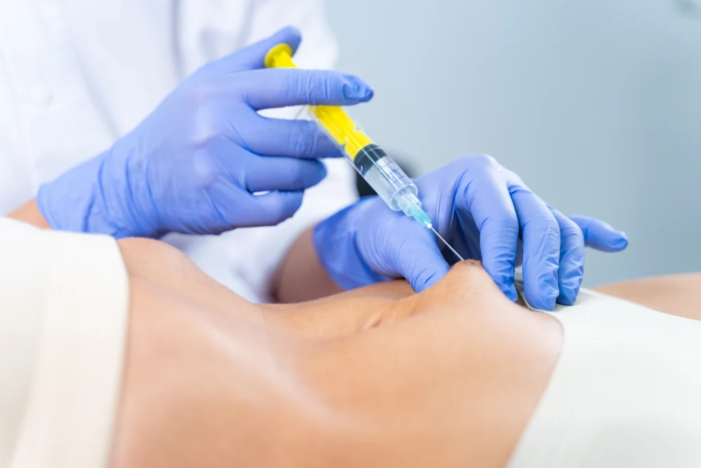 Fat Dissolving Injections